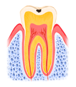 エナメル質齲蝕